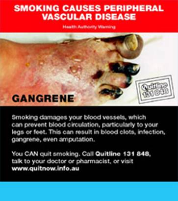 Australian Cig Warning Large